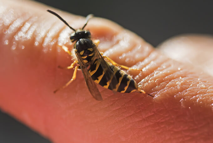 蜂に刺されたときの治療